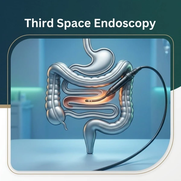 Third space endoscopy